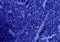 New biomedical carbons: from Lab to Market