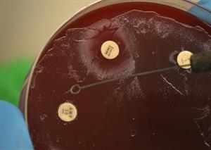 Fighting superbugs