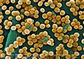 Rapid detection of superbugs