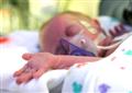 The art of enrolling preterm babies in clinical trials