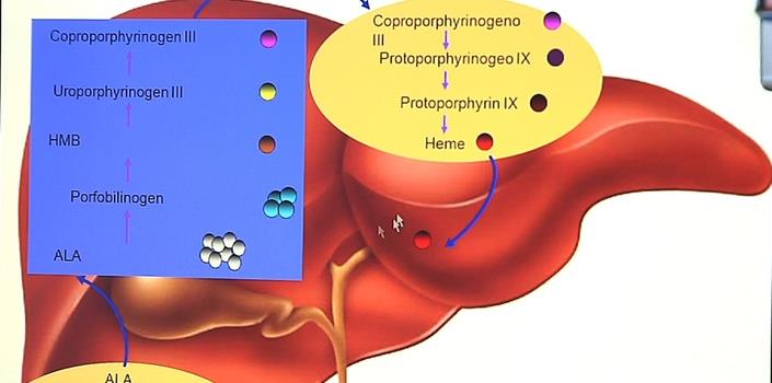 Renewed hope for gene therapy in rare disease